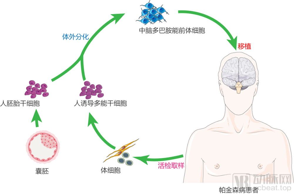 神经干细胞移植最新进展,神经干细胞移植技术前沿