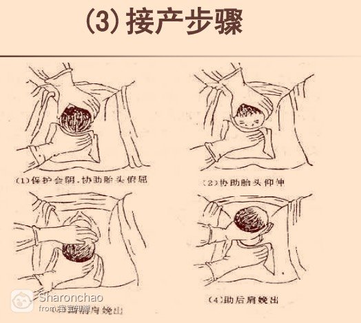 最新分娩流程解析图解